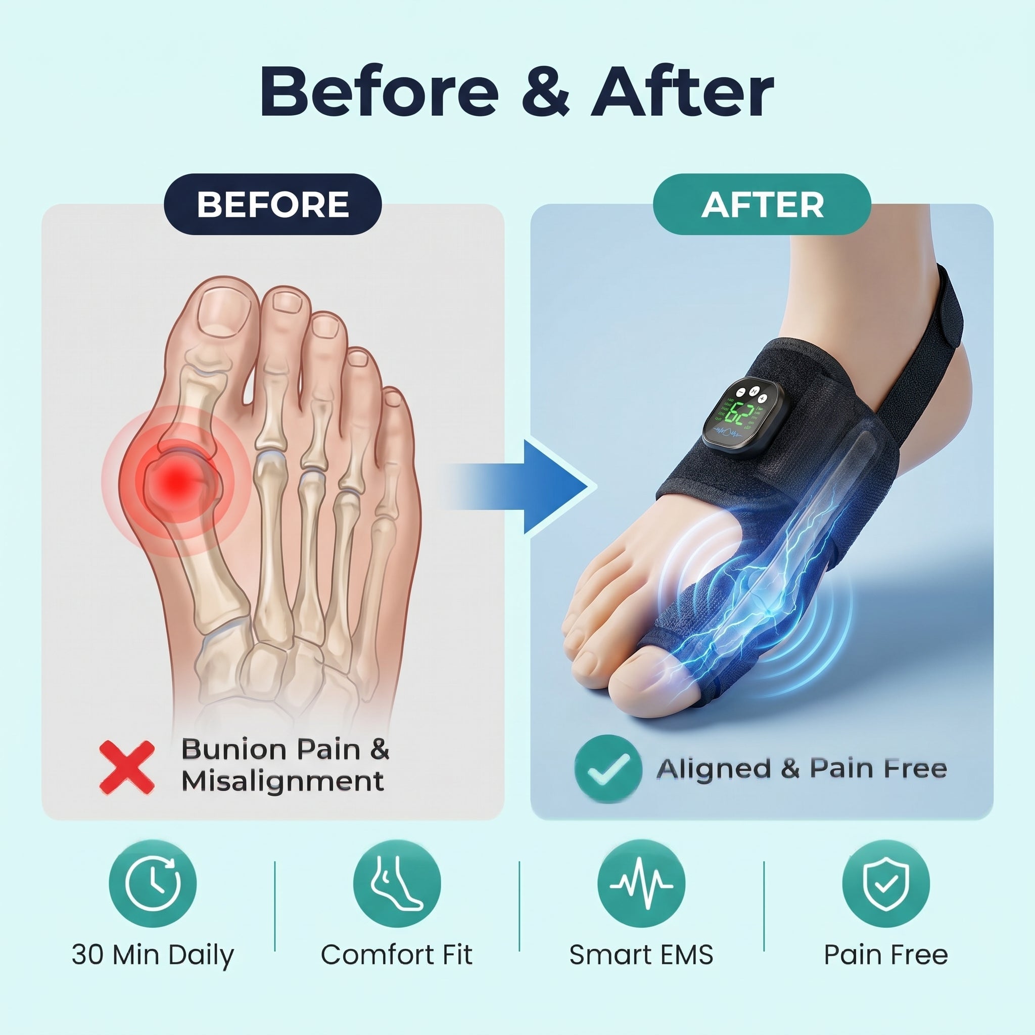 NexAlign Pro EMS Bunion Corrector