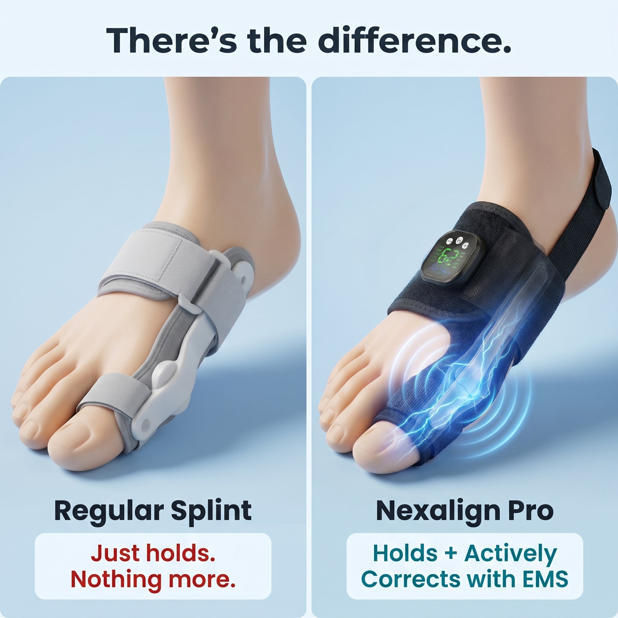 NexAlign Pro EMS Bunion Corrector